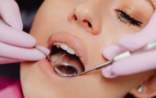 Dental Hygienist Notices Cancerous Spot on Patient’s Tongue: What Happened Next?