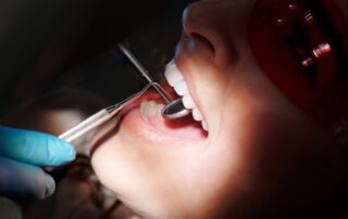 Why Do Dental Professionals Currently Have Concerns Over the Federal Dental Plan?