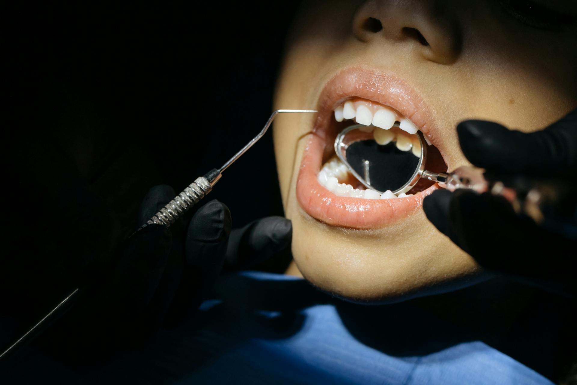 How Are Adolescent’s Stress Levels Impacted by Tooth Extractions?