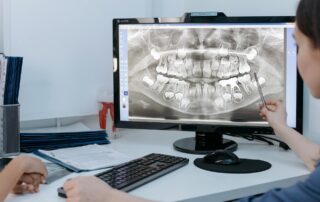 Direct Composite or Zirconia: Which Is Better for Replacing a Single Missing Anterior Tooth?