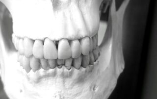 How Can 3D Printed Bone Scaffolds Help With Jaw Regeneration?