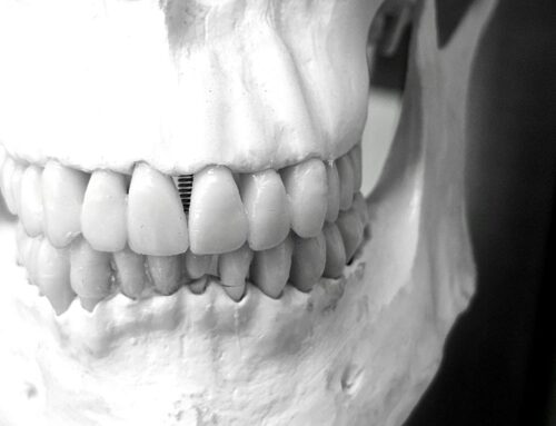 How Can 3D Printed Bone Scaffolds Help With Jaw Regeneration?